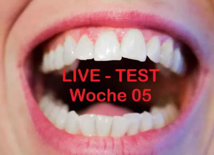 Live Test Woche 5 - Zahnlöcher bzw. Zähne selber heilen?