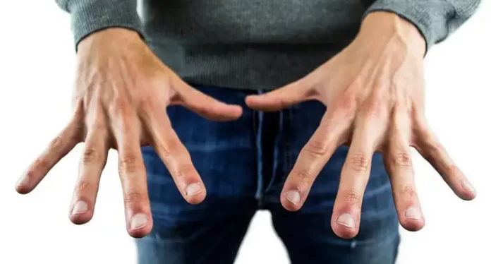 Brüchige Nägel - Ein Mann zeigt seine Hände